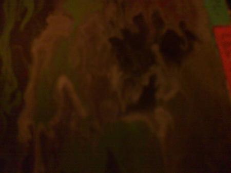 ~ Dgradat'ioneuronale...~